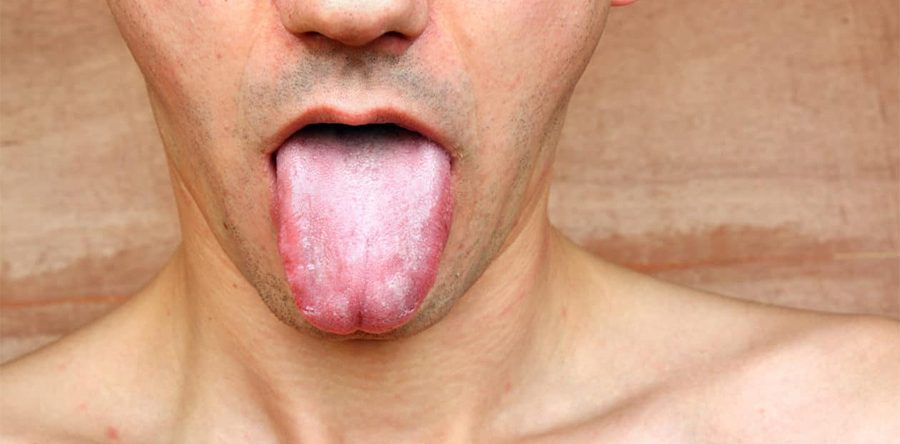 how-does-dry-mouth-affect-your-oral-and-overall-body-health